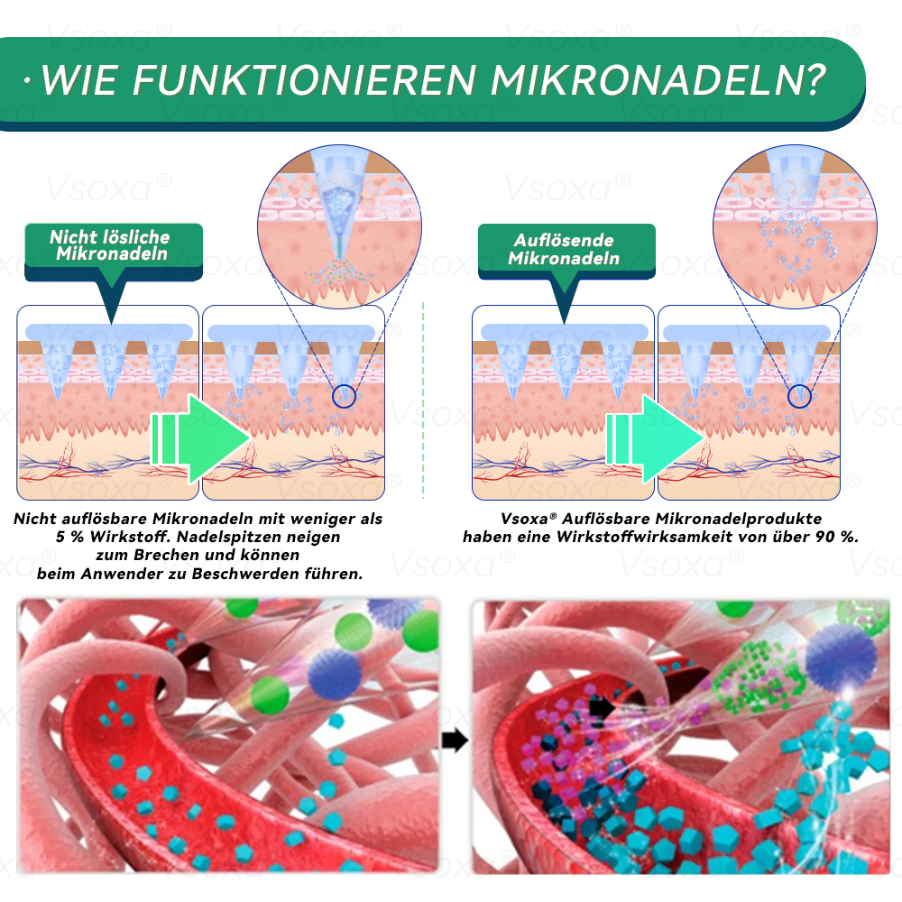 🔥 Letzter Slot verfügbar! ⚡ Jetzt 30 % Rabatt sichern – nur für kurze Zeit! Vsoxa® SMGT-GLP-1 Nano-Mikronadel-Pflaster (Keine Schmerzen, 24/7 Wirkung – verliere schnell bis zu 9 kg, strafft schlaffe Haut, 90 % weniger Heißhunger auf Zucker)
