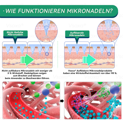 🔥 Letzter Slot verfügbar! ⚡ Jetzt 30 % Rabatt sichern – nur für kurze Zeit! Vsoxa® SMGT-GLP-1 Nano-Mikronadel-Pflaster (Keine Schmerzen, 24/7 Wirkung – verliere schnell bis zu 9 kg, strafft schlaffe Haut, 90 % weniger Heißhunger auf Zucker)